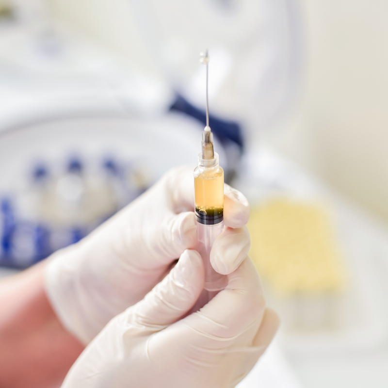 prp therapy